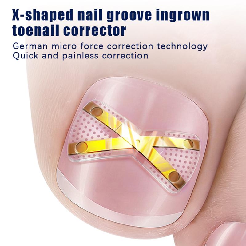 Calibrateur d'ongles incarnés  - Nail File Titanium avis et prix